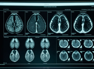 Starea de sănătate a lui Donald Trump: Rezultatele RMN-ului confirmă o "condiție excelentă"