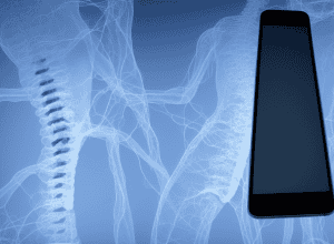 Pacienții cu probleme de spate sunt acum cu 20 de ani mai tineri – diagnostic: «gât de smartphone»!