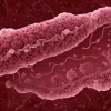 Descoperire Majoră: Bacteriile Intestinale Pot Provoca Calcificarea Vaselor de Sânge și Risc de Infarct