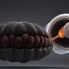 O minge de păr de un kilogram, extrasă din stomacul unei adolescente din Anglia, de mărimea unui pepene