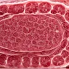 Alertă alimentară: REWE retrage salam periculos – risc de insuficiență renală din cauza bacteriei E. coli
