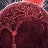 Sepsisul: Un Pericol Mortal, mai Periculos decât Infarctul – O Cincime din Decesele Globale sunt Cauzate de Infecția Sanguină